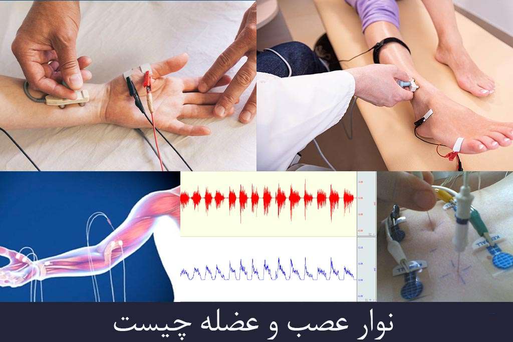 مرکز نوار عصب و عضله تهران ویستان ارتباط با مرکز نوار عصب و عضله تهران