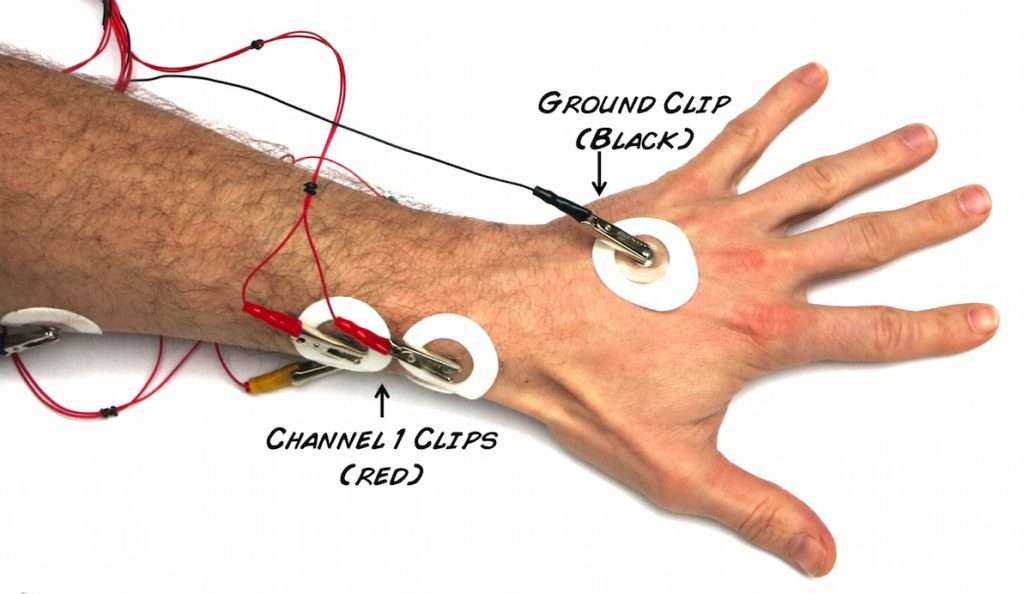الکترود های متصل شده به عصب های دست بدون ایجاد درد وضعیت عصب ها را بررسی میکنند