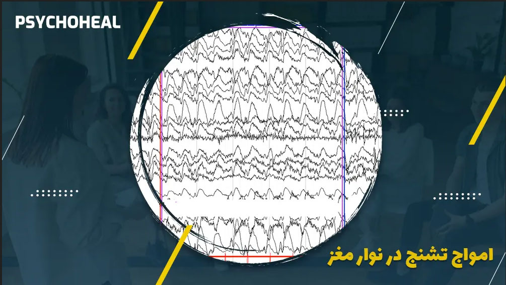 عکس نوار مغز تشنجی