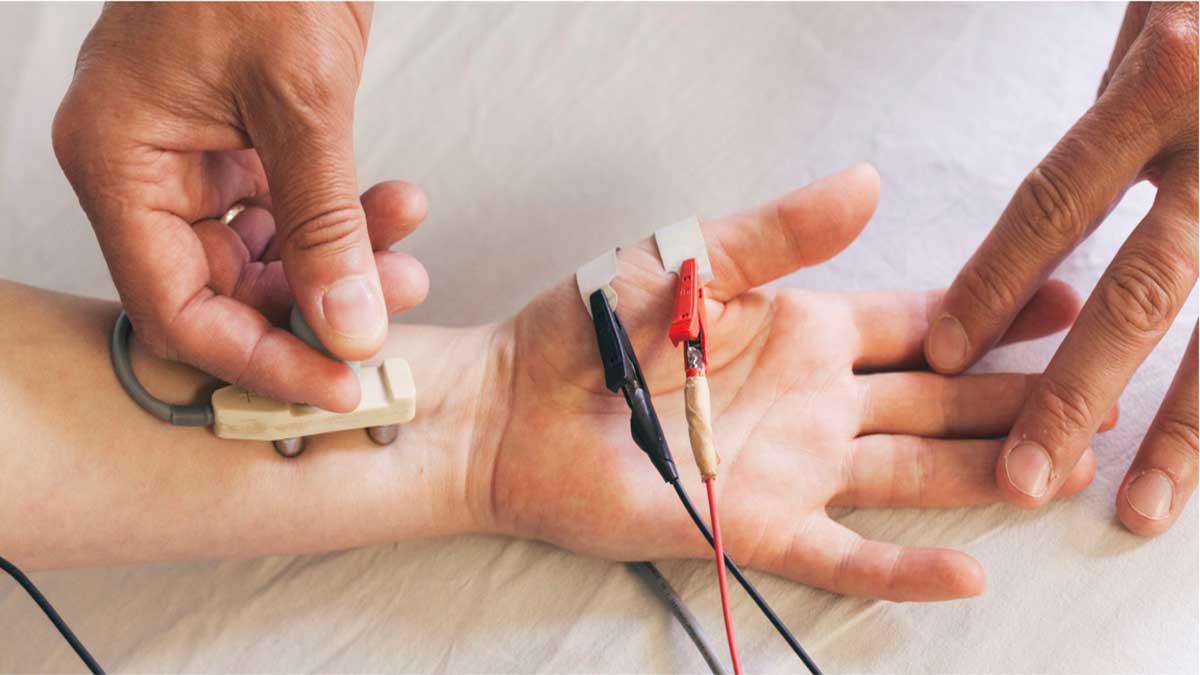 الکترودهایی برای انجام نوار عصب دست