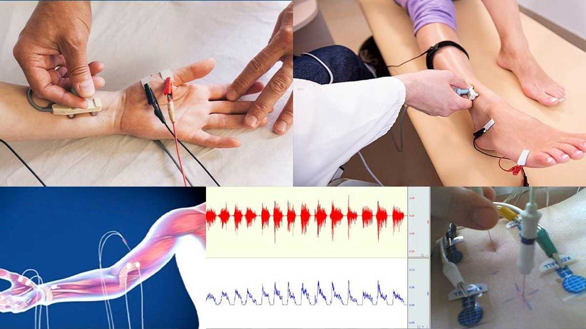آسیب های عصبی