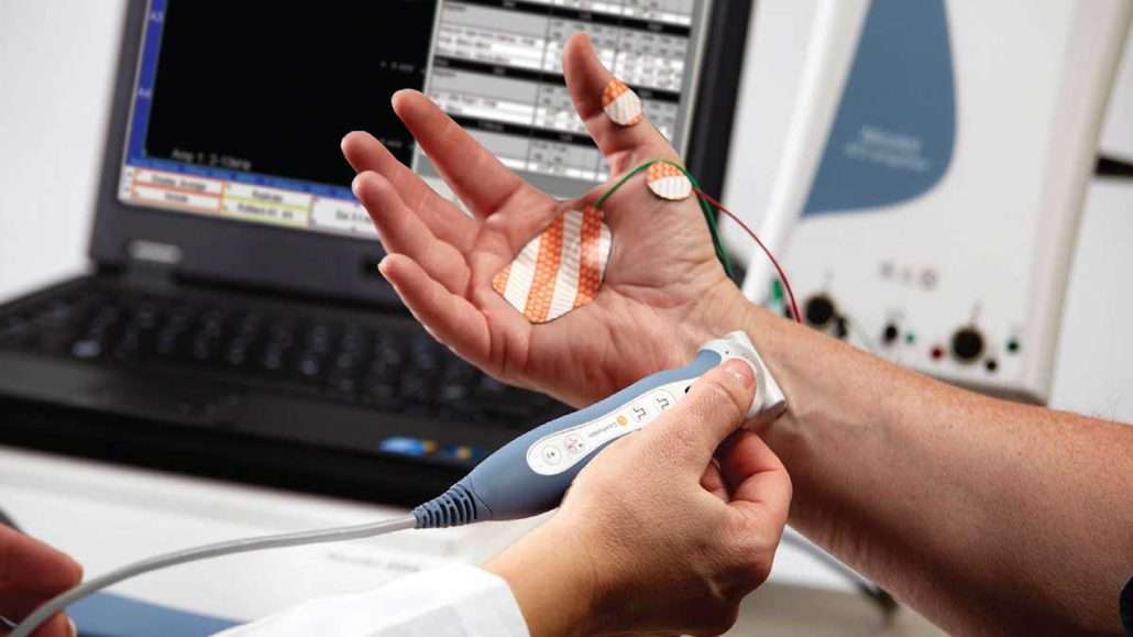 تحریک الکتریکی اعصاب دست