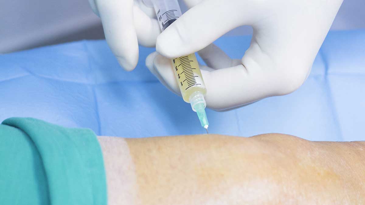 تزریق PRP