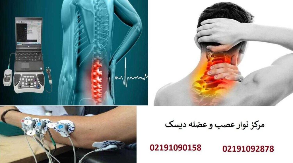 نوار عصب دیسک چیست؟ تشخیص مشکلات نخاعی با تست EMG