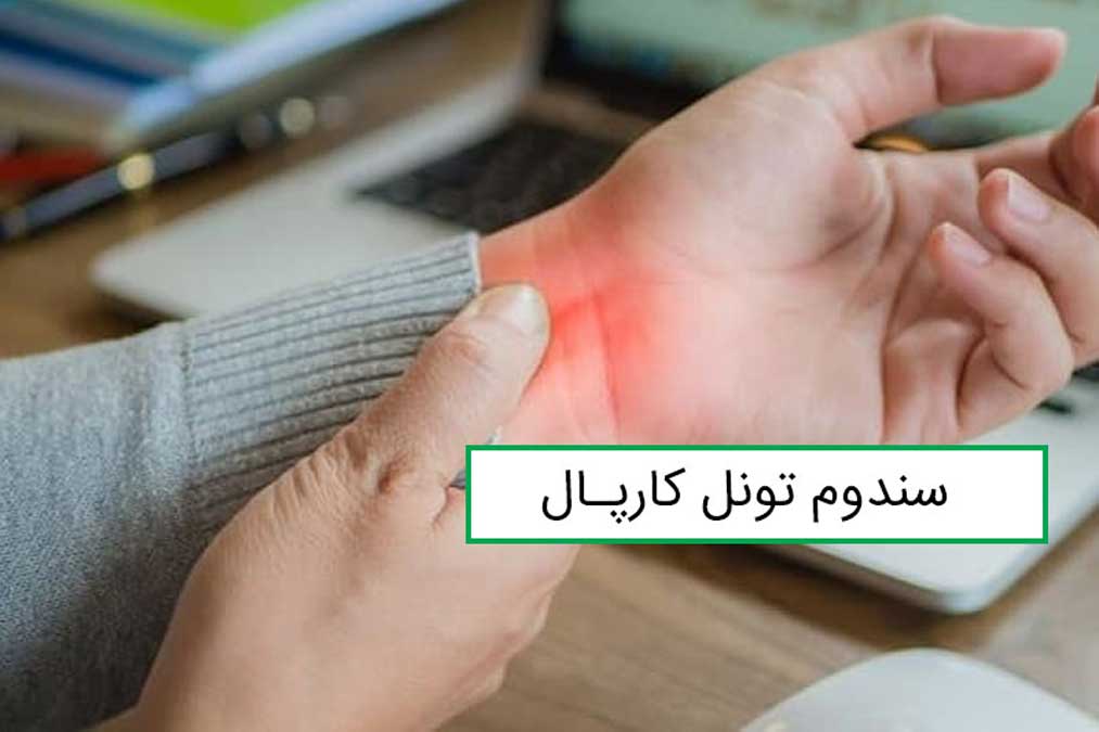 سندروم تونل کارپال چیست
