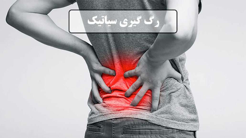 پا درد و عصب سیاتیک