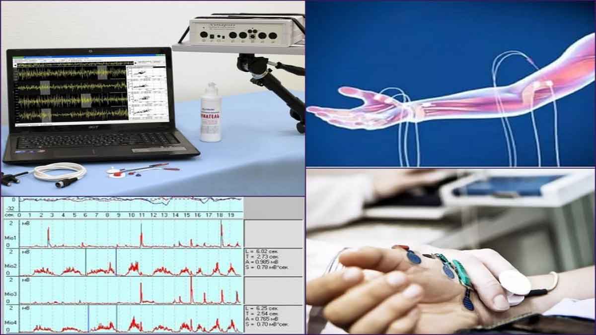 تست EMG NCS برای تشخیص فلج مغزی