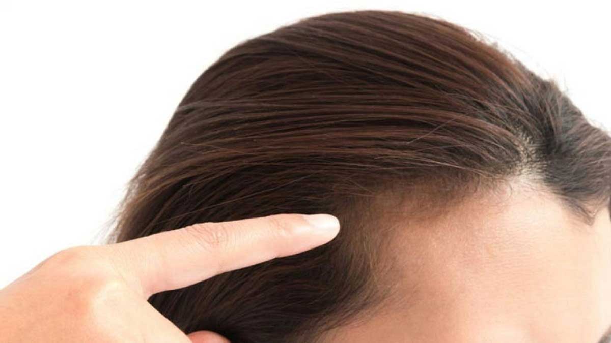 هزینه پی ار پی مو در ویستان