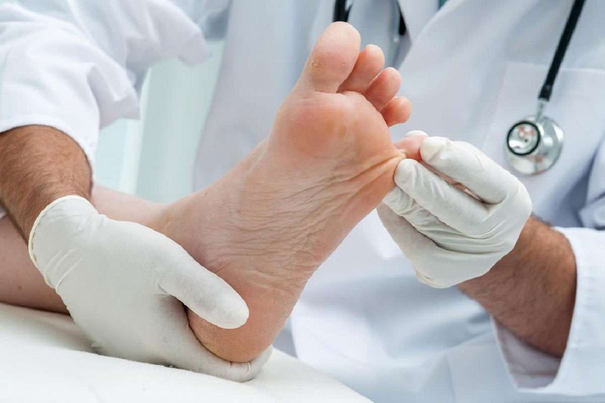 علت ایجاد میخچه 