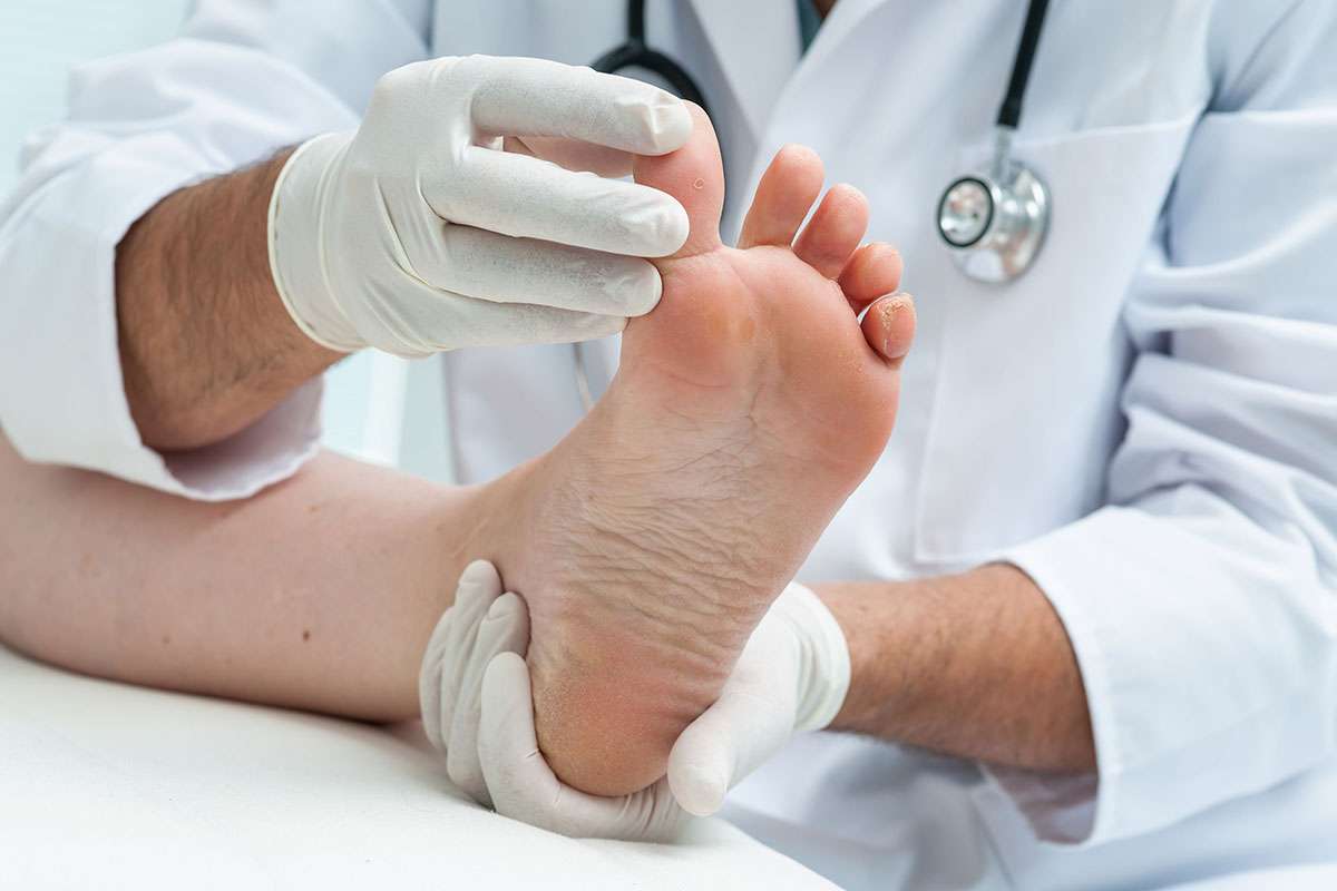 درمان میخچه پا در کلینیک ویستان