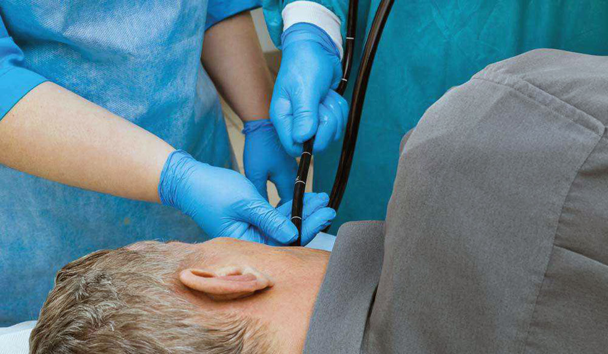 مراقبت بعد از آندوسکوپی معده