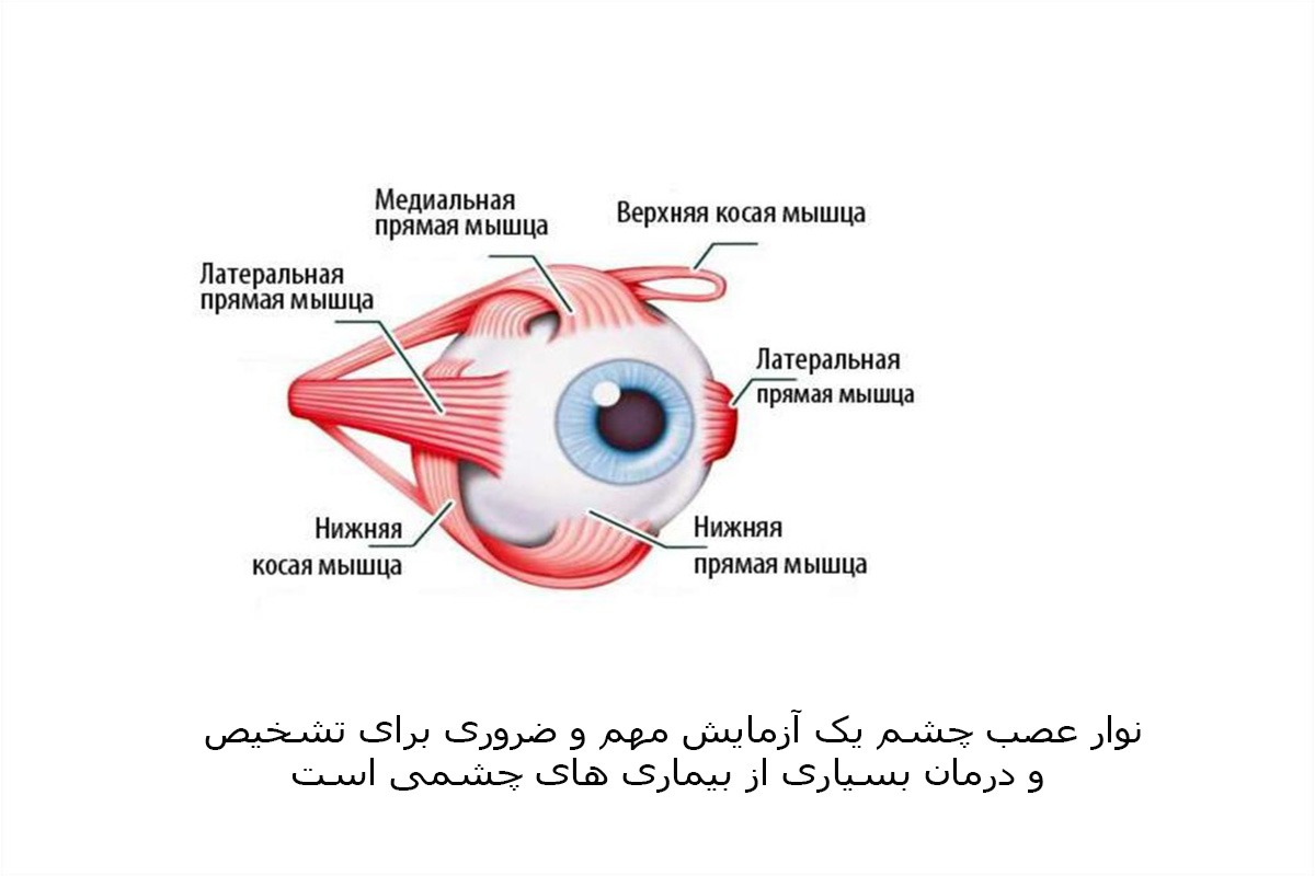 مرکز نوار عصب چشم