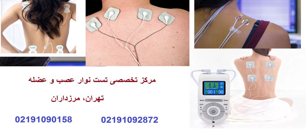 تفسیر نوار عصب کمر | تحلیل نتایج EMG و NCV کمر به زبان ساده