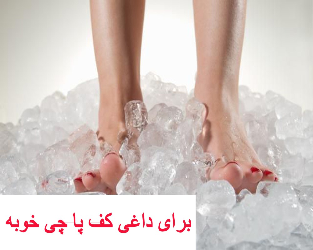 برای داغی کف پا چی خوبه