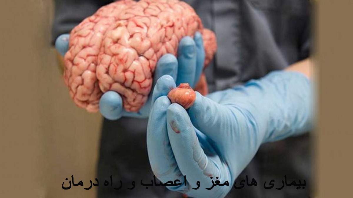 بیماری های مربوط به مغز و اعصاب 