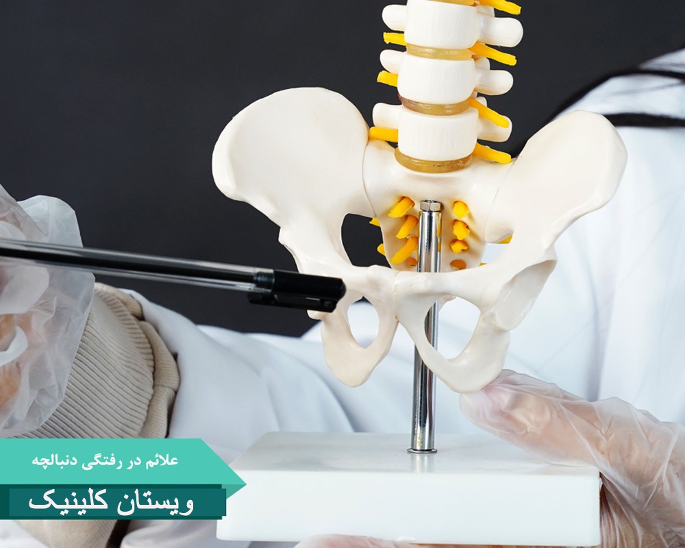 درمان دنبالچه با هزینه مناسب در کلینیک ویستان