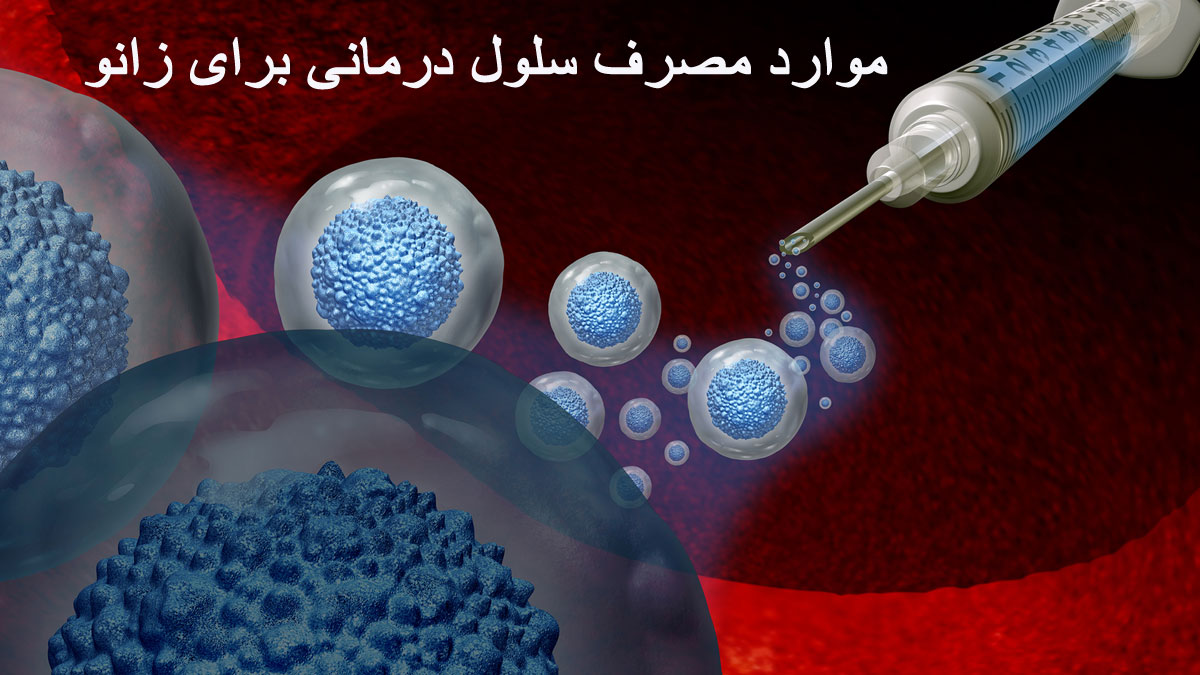 موارد مصرف سلول درمانی