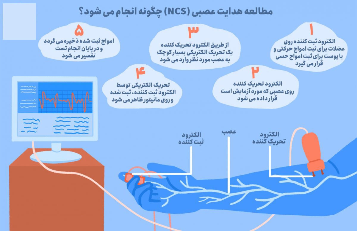 تست نوار عصب و عضله (EMG)
