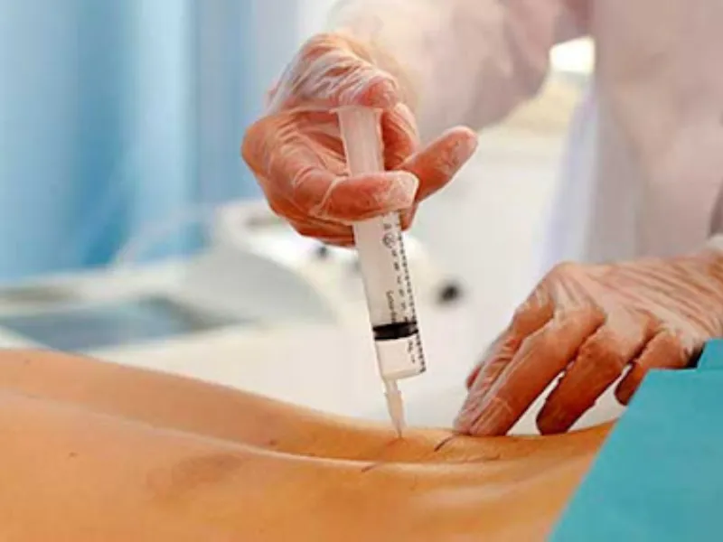 هدف از انجام اوزون تراپی دیسک کمر