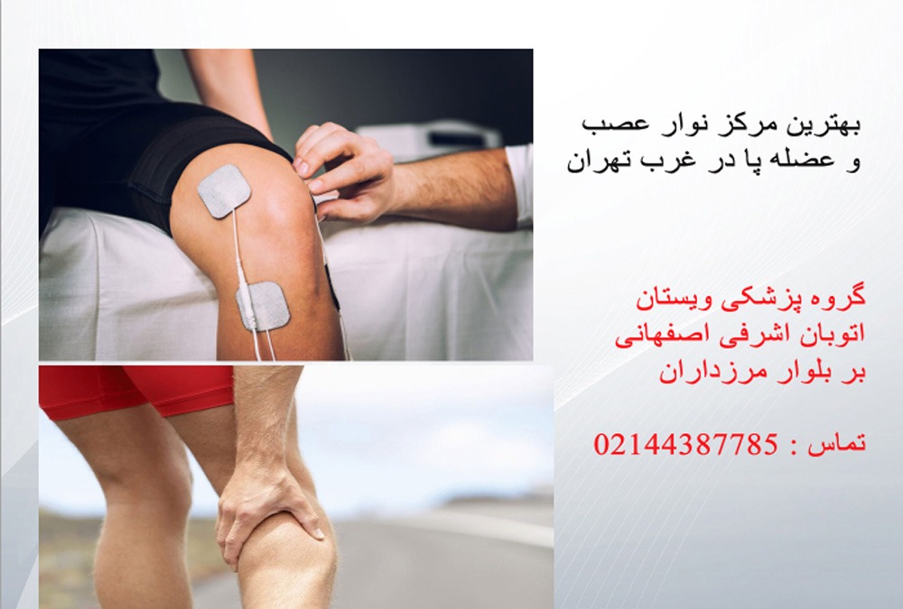 بهترین مرکز نوار عصب پا