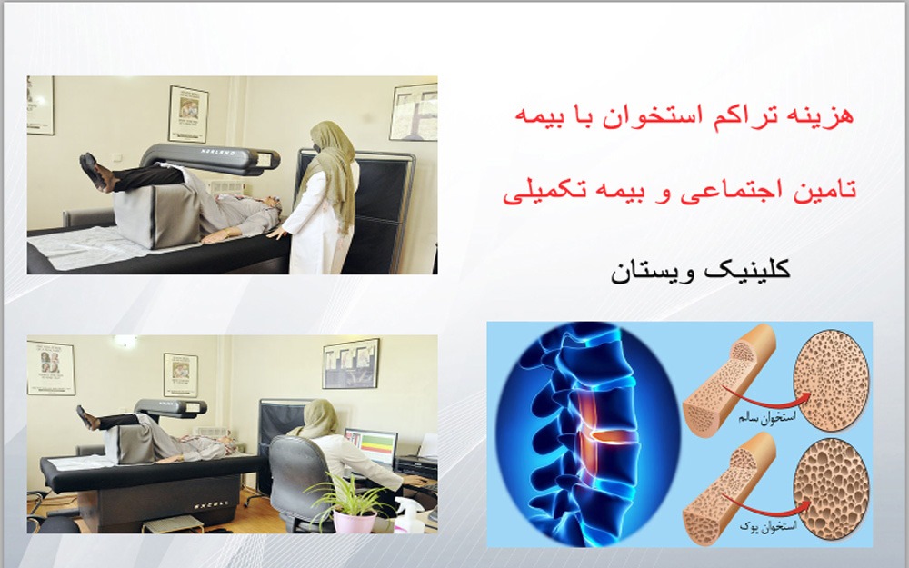 قیمت تست تراکم استخوان با بیمه تامین اجتماعی