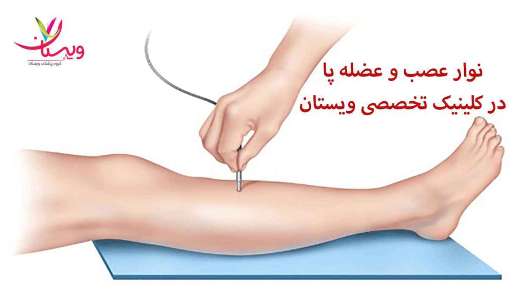نوار عصب عضله پا در کلینیک ویستان