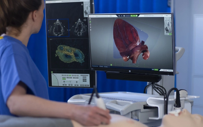 اکو قلب با بیمه اکو قلب با بیمه آسیا