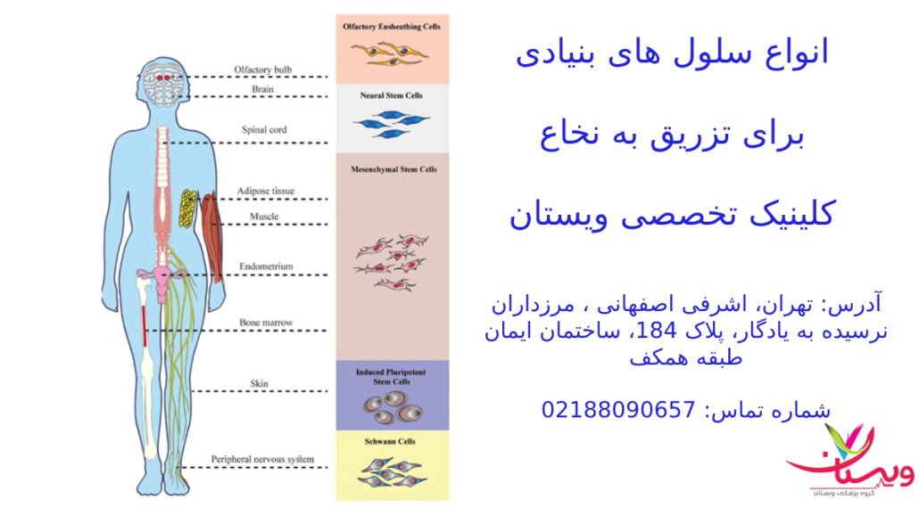 انواع سلول بنیادی جهت تزریق به نخاع