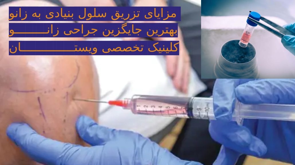 مزایای تزریق سلول بنیادی به زانو - ویال مربوط به سلول بنیادی و تزریق آن به بیمار