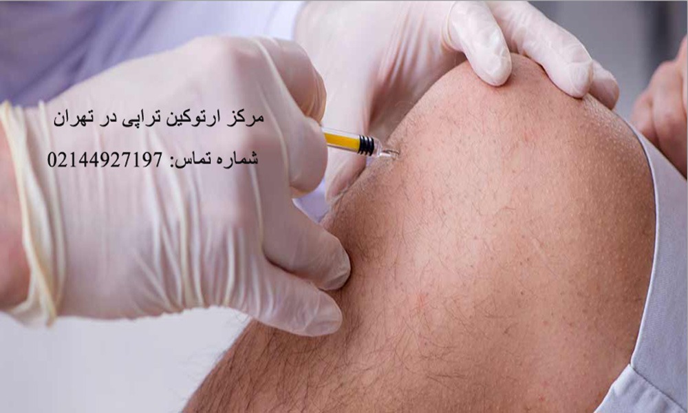 هزینه ارتوکین تراپی زانو آزاد