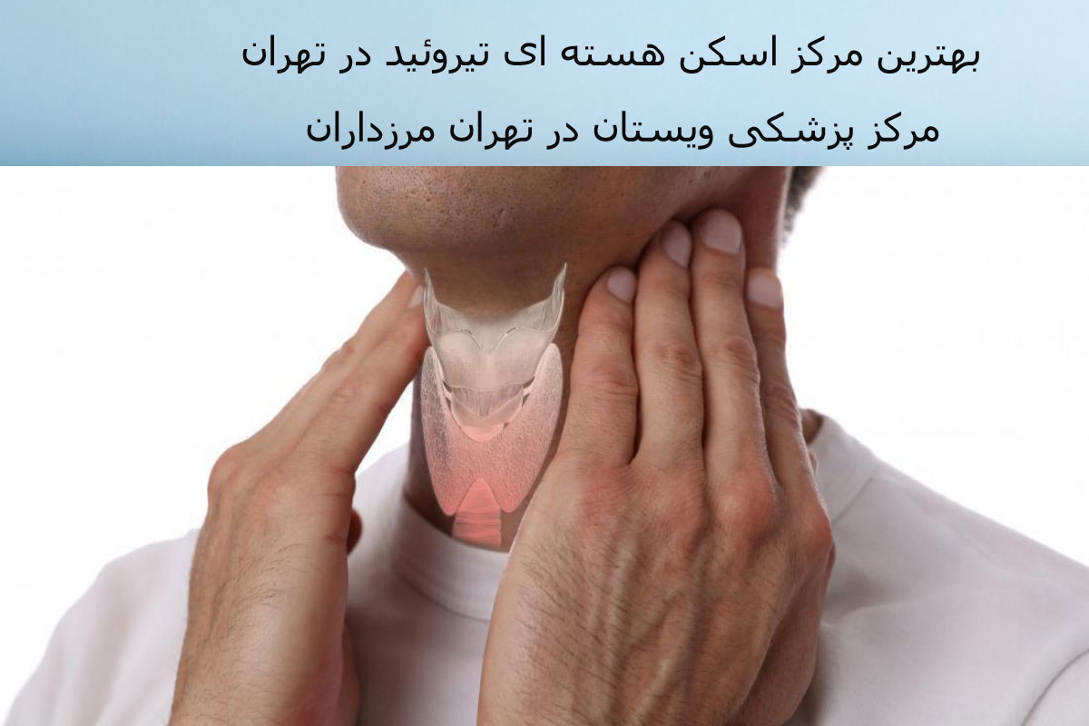 هزینه اسکن تیروئید آزاد 