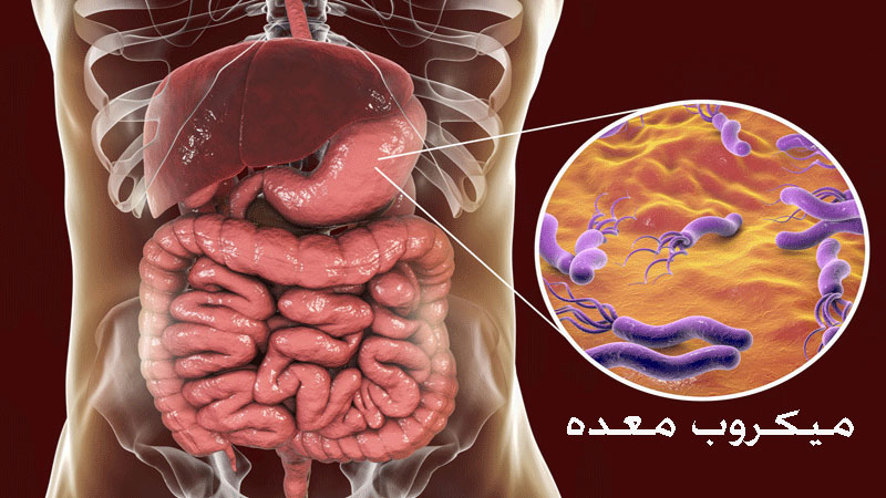 عکس میکروب معده در اندوسکوپی