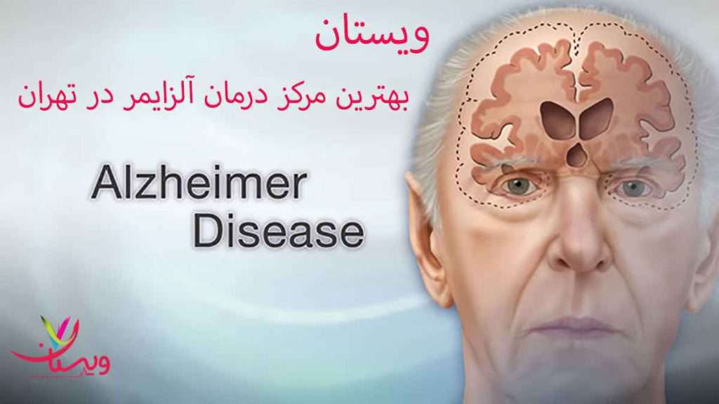 بیمارستان تخصصی مغز و اعصاب تامین اجتماعی تهران