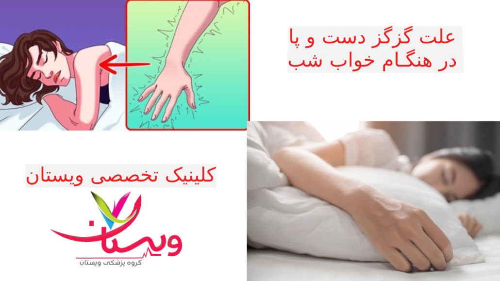  بی حسی دست و پا هنگام خواب تصویری از گزگز دست و پا هنگام خواب 