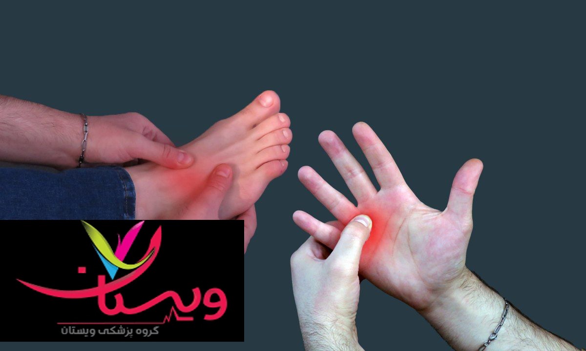 گزگز دست و پا 