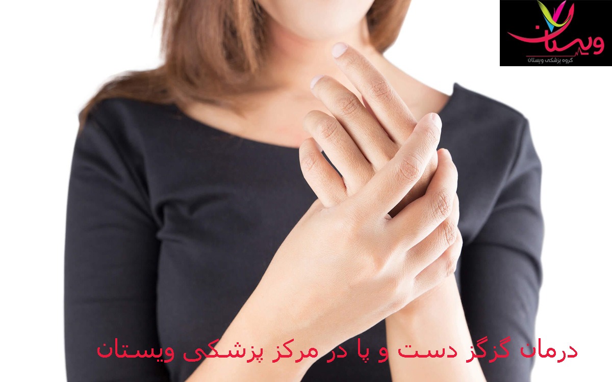 درمان بی حسی دست راست