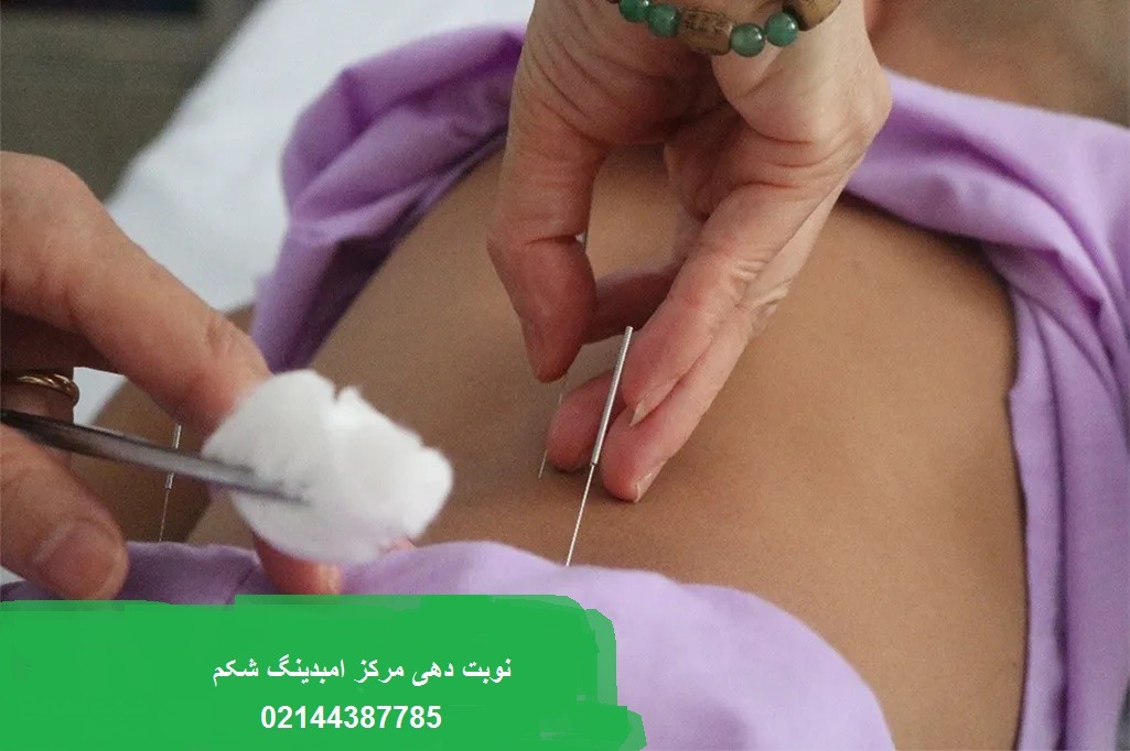 لیست 10 تا از بهترین مراکز امبدینگ شکم در تهران