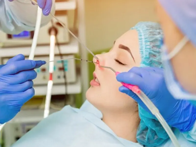 آندوسکوپی از طریق بینی