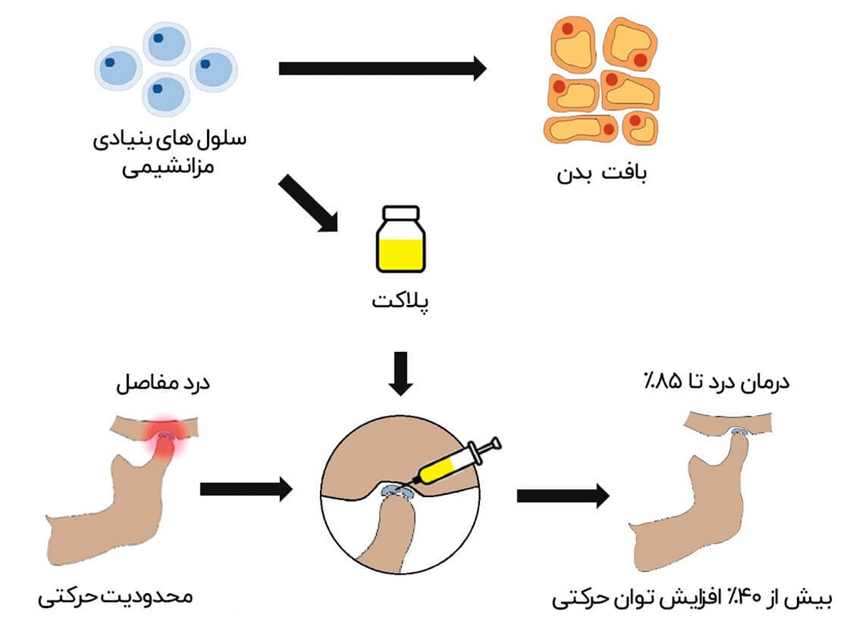 فرایند اگزوزوم تراپی زانو