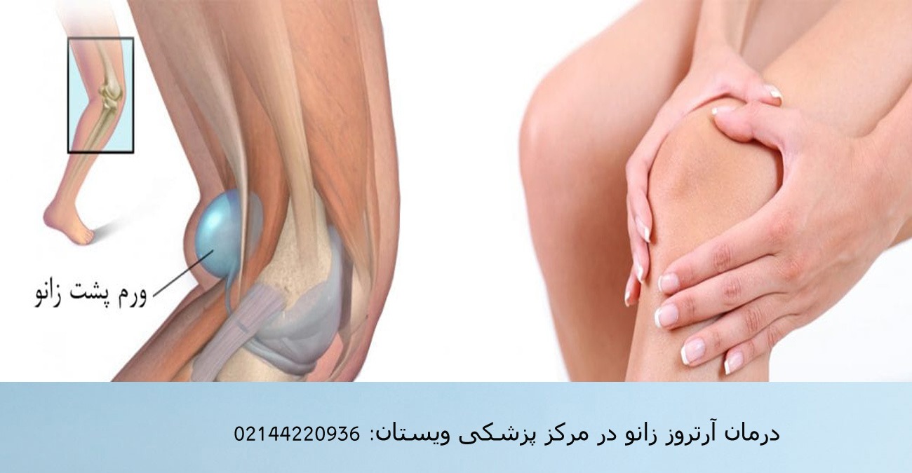 قیمت ژل رودیاکس 
