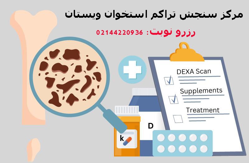 مرکز سنجش تراکم استخوان تهران