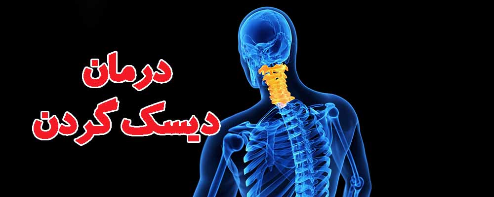 درمان دیسک گردن