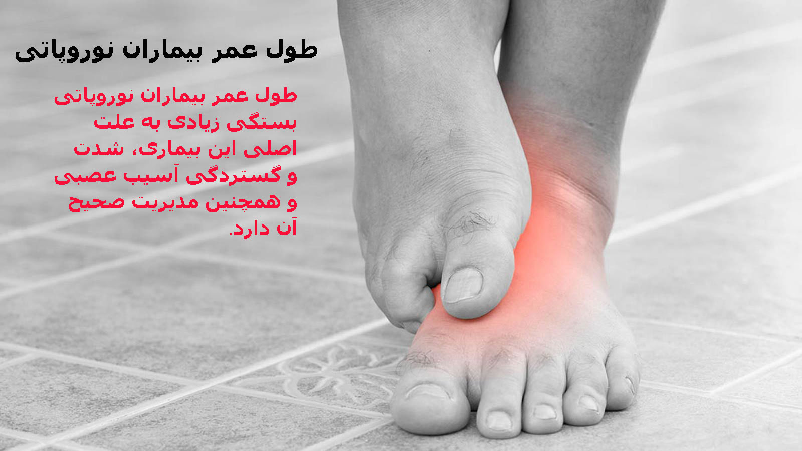 طول عمر بیماران نوروپاتی