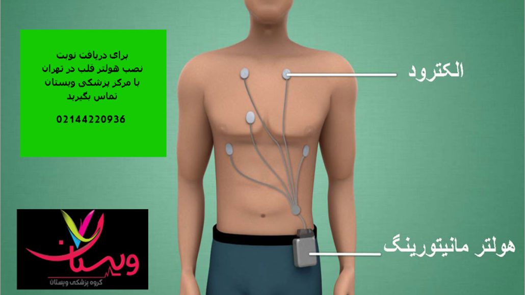 هزینه هولتر 24 ساعته قلب در تهران + اجاره هولتر قلب (ویستان)