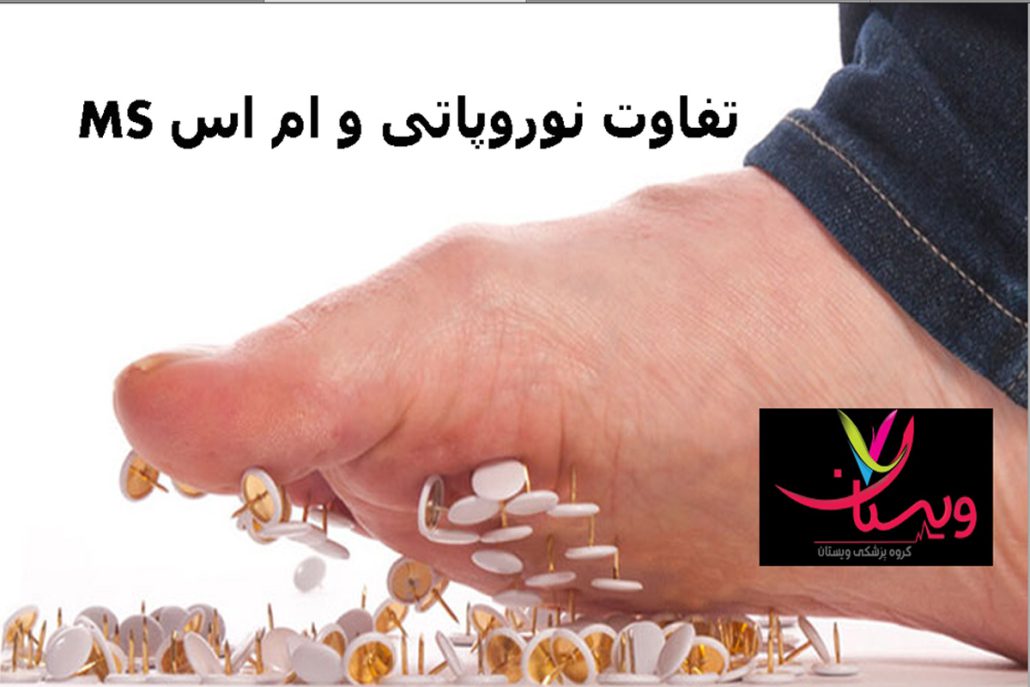 تفاوت نوروپاتی و ام اس + طول عمر بیماران نوروپاتی چقدر است