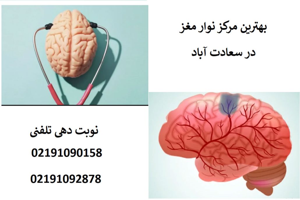 مرکز نوار مغز در سعادت آباد