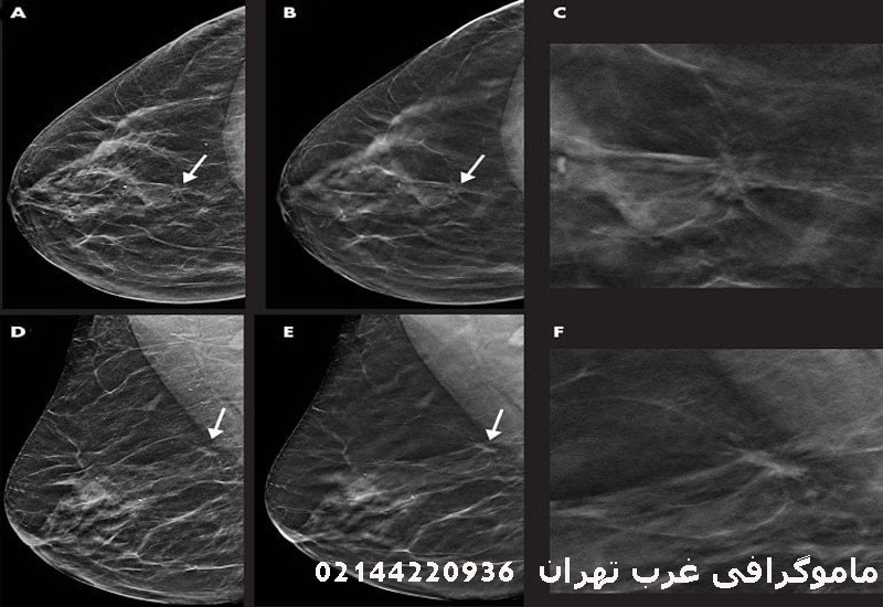 مرکز پزشکی ویستان ماموگرافی غرب تهران
