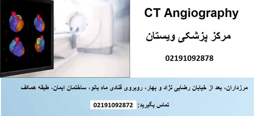 سی تی آنژیوگرافی در غرب تهران