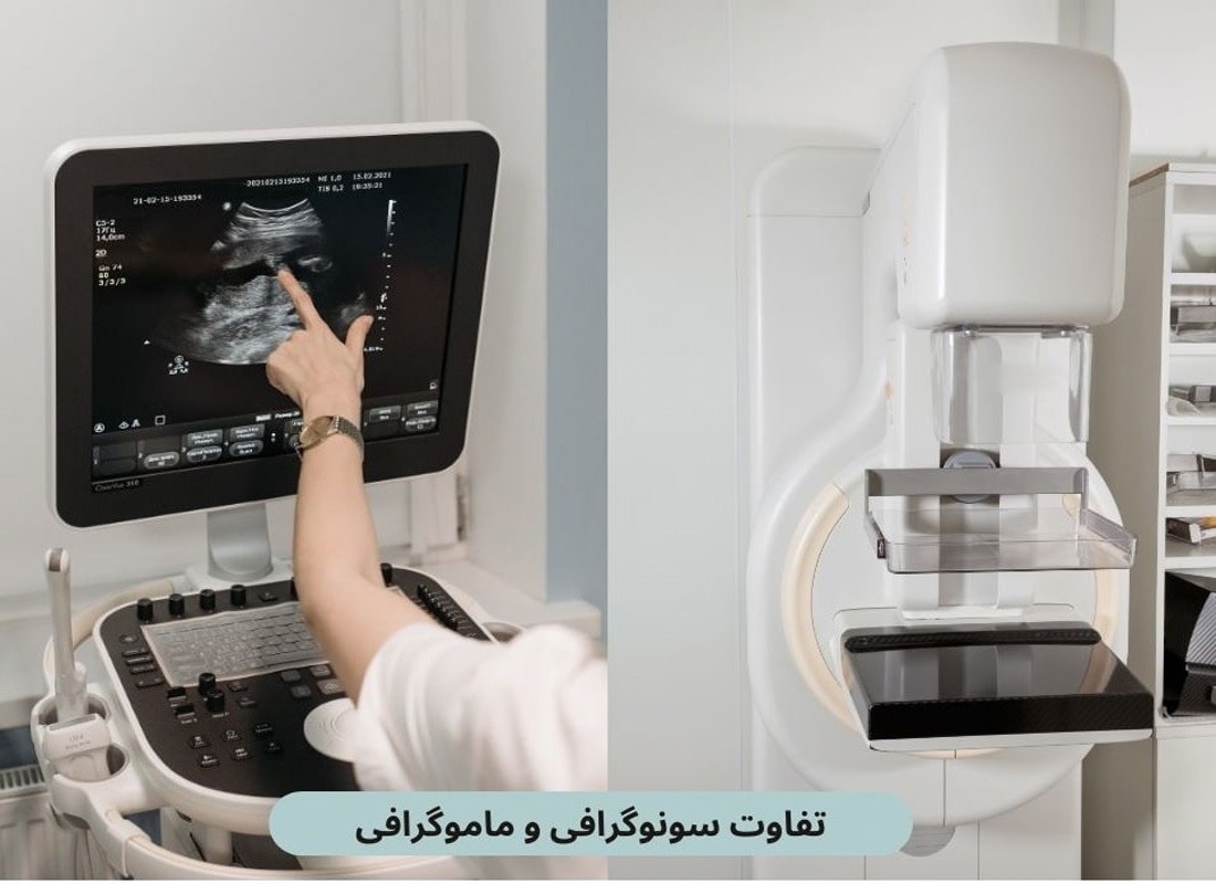تفاوت سونوگرافی و ماموگرافی