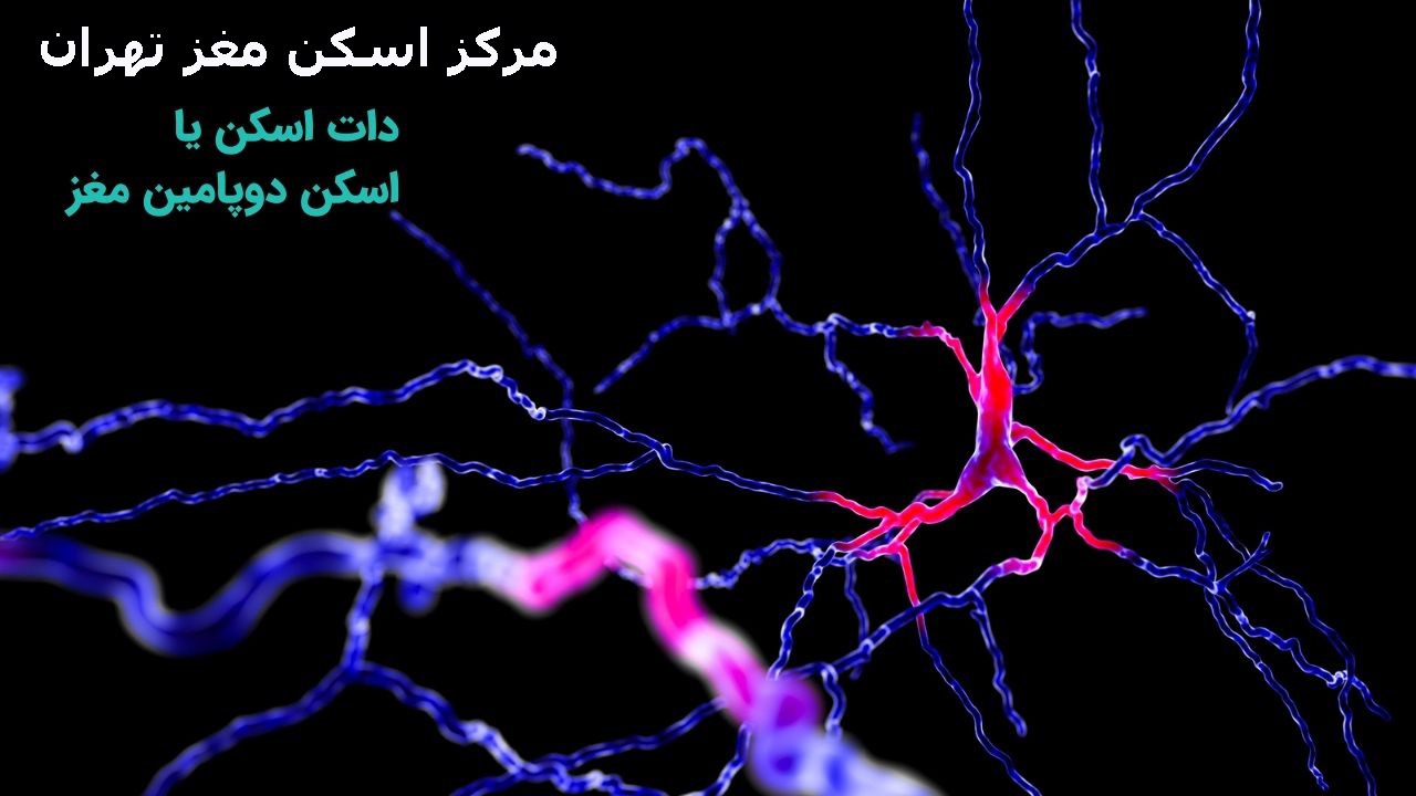 تشخیص بیماری پارکینسون با Datscan
